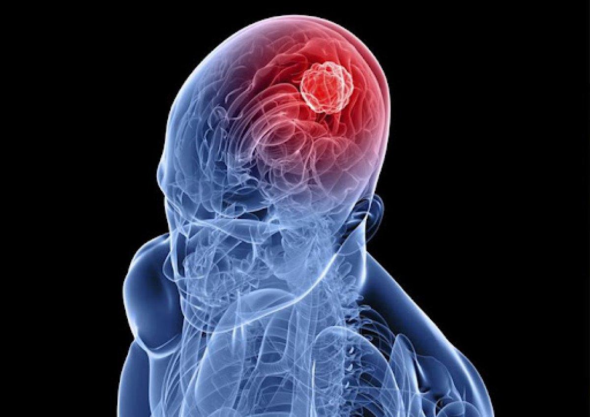 Çok az bilinen 5 kanser türü