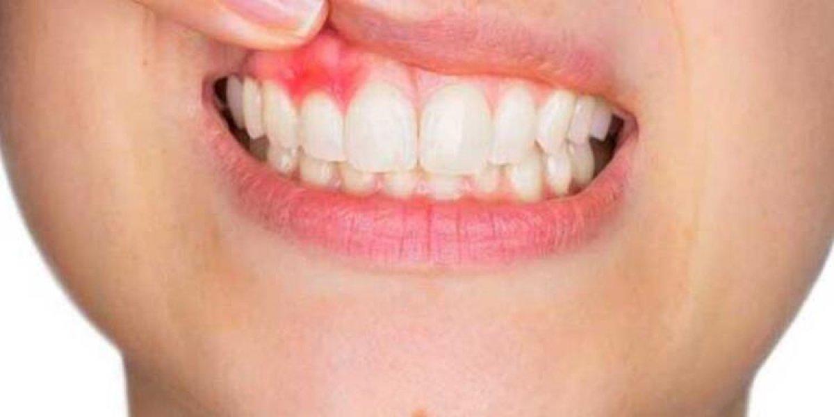 Ağız kuruluğu diyabet belirtisi olabilir