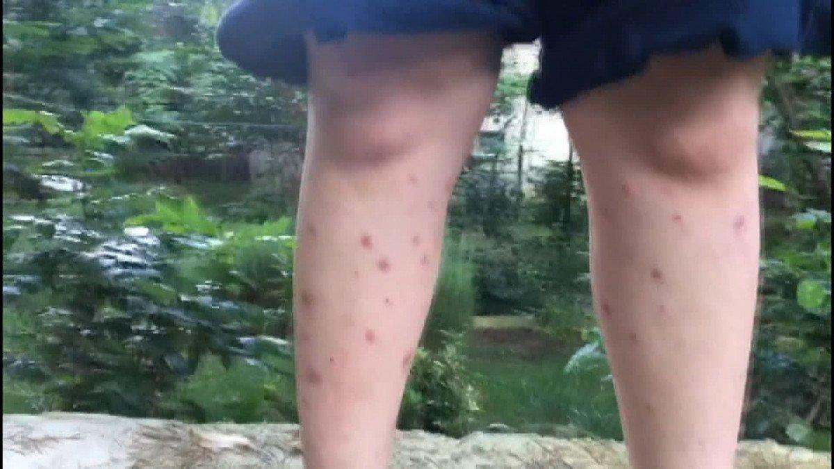 İstanbul’un sivrisinek üreme haritası