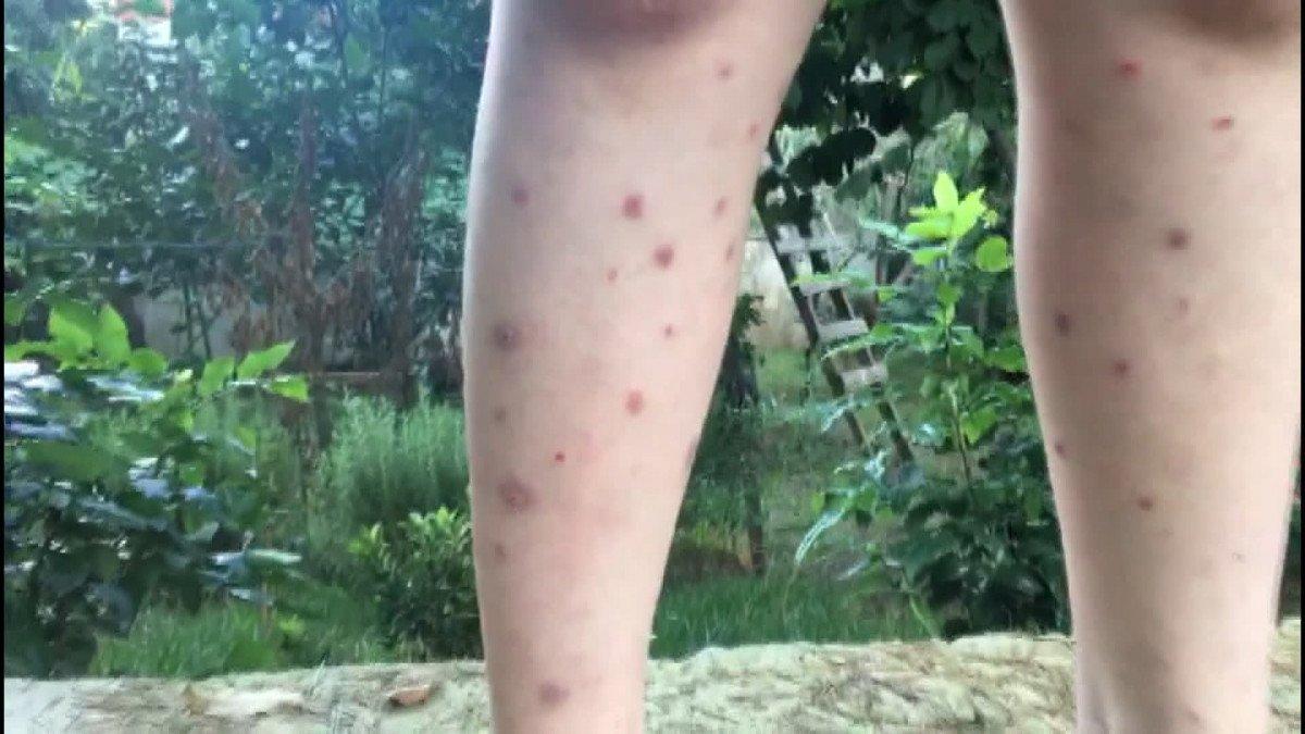 İstanbul’un sivrisinek üreme haritası