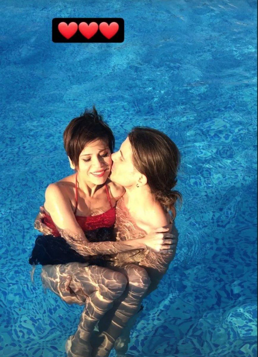 Aydilge: Bizde botoks yok