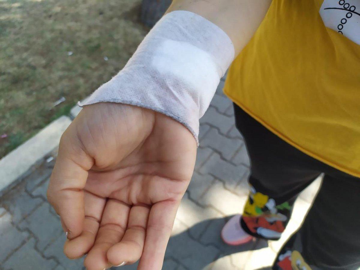 Gaziantep'te bir kadın, boşanmak istediği eşi tarafından darbedildi