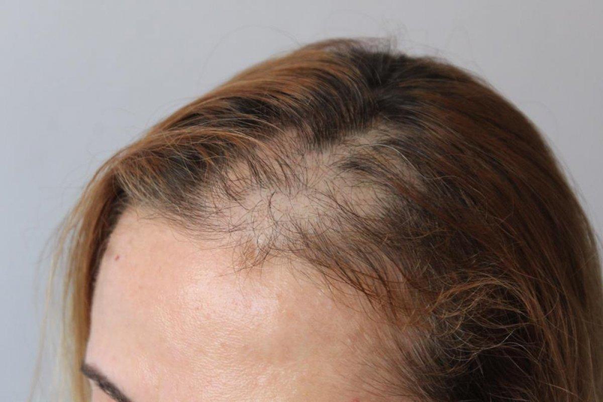 Gaziantep'te kadın hasta hemşireye saldırdı