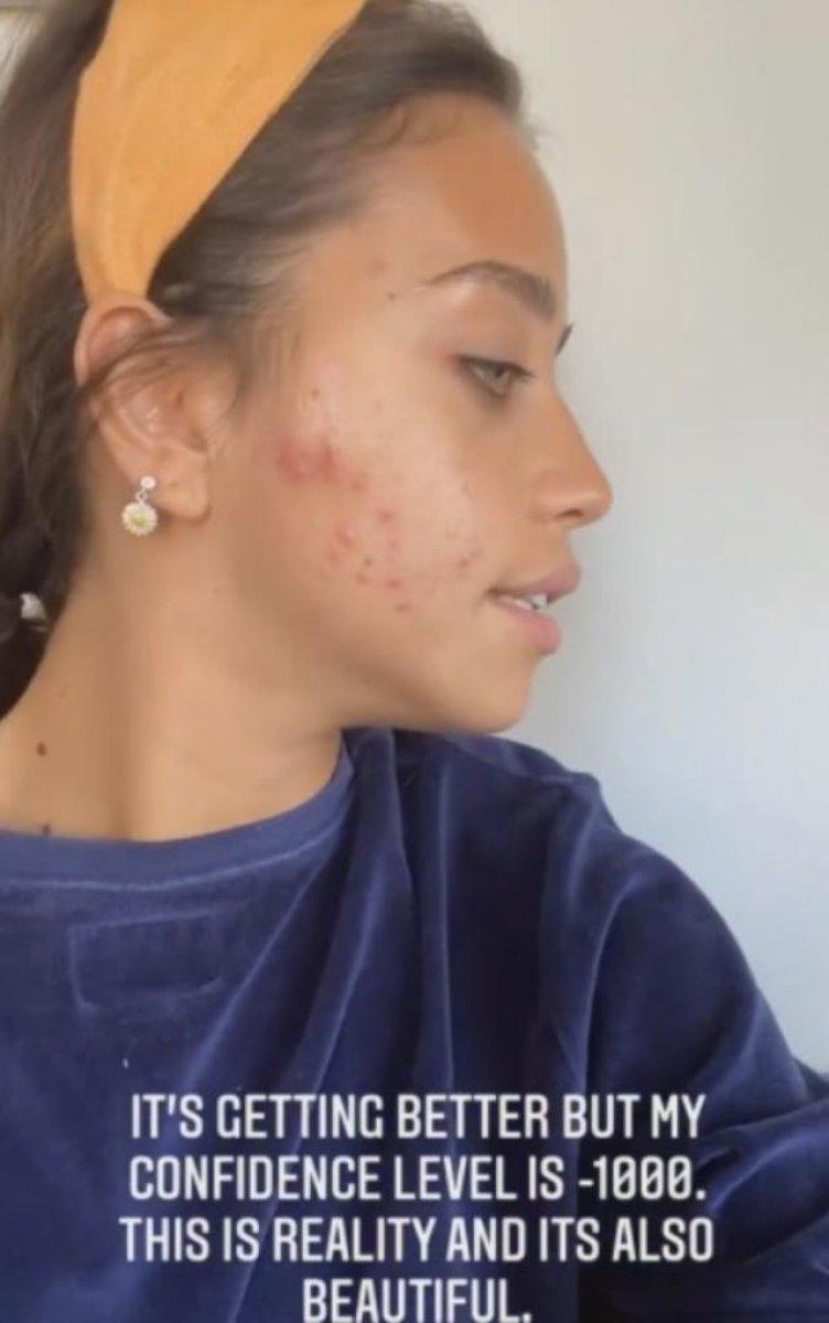 Zeynep Alkan, 'kusursuz güzellik' dayatmasına isyan etti