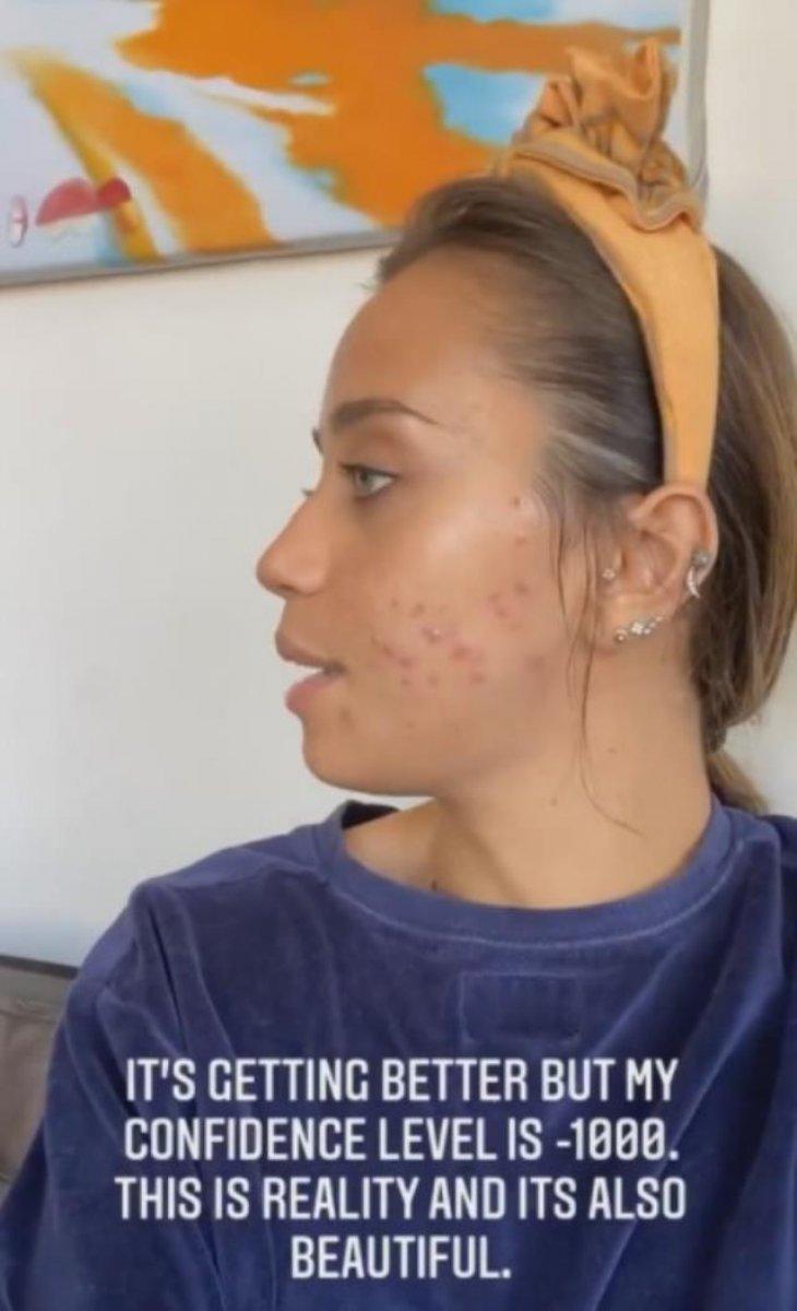 Zeynep Alkan, 'kusursuz güzellik' dayatmasına isyan etti