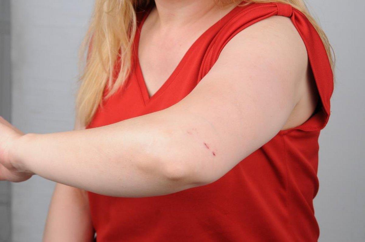 Gaziantep'te kadın hasta hemşireye saldırdı