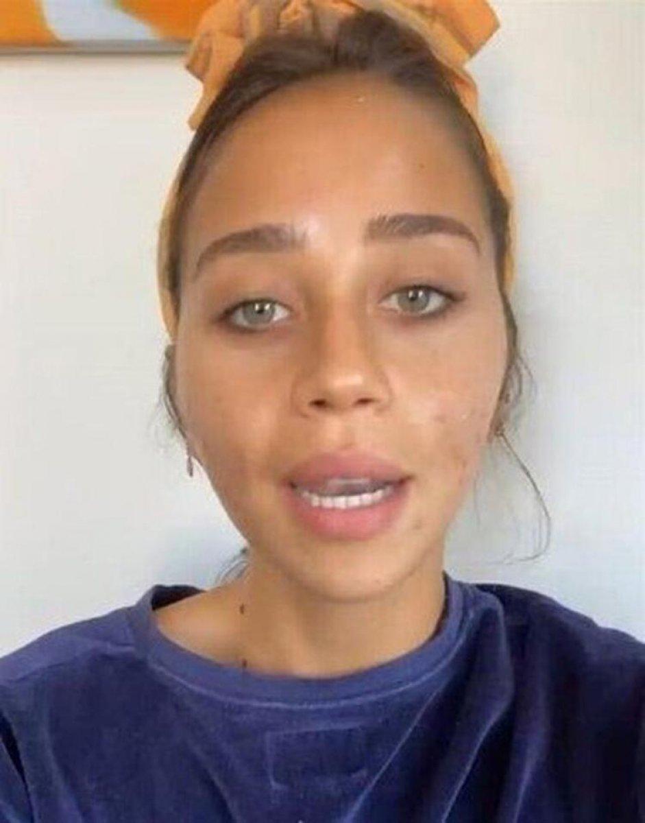 Zeynep Alkan, 'kusursuz güzellik' dayatmasına isyan etti