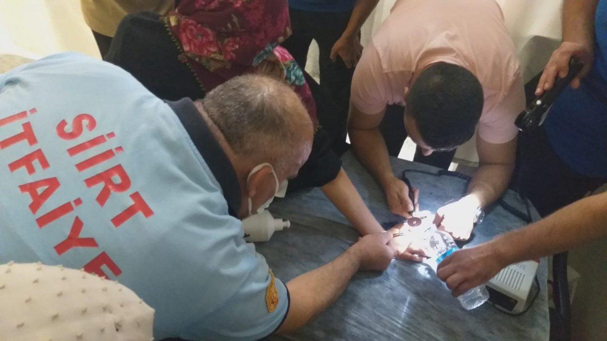 Siirt’te, genç kızın parmağında sıkışan yüzük 1 saatte çıkarıldı