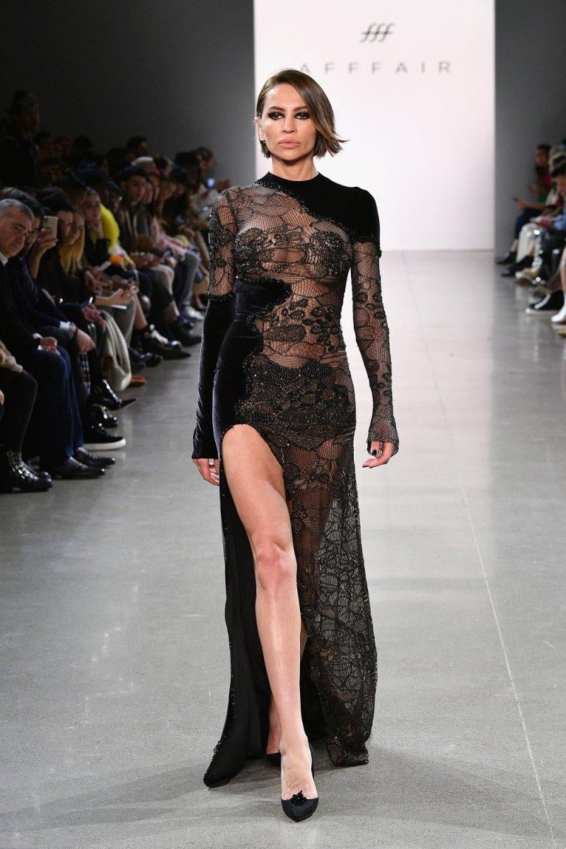 Günay Musayeva: Silikonlarımı çıkarttırdım