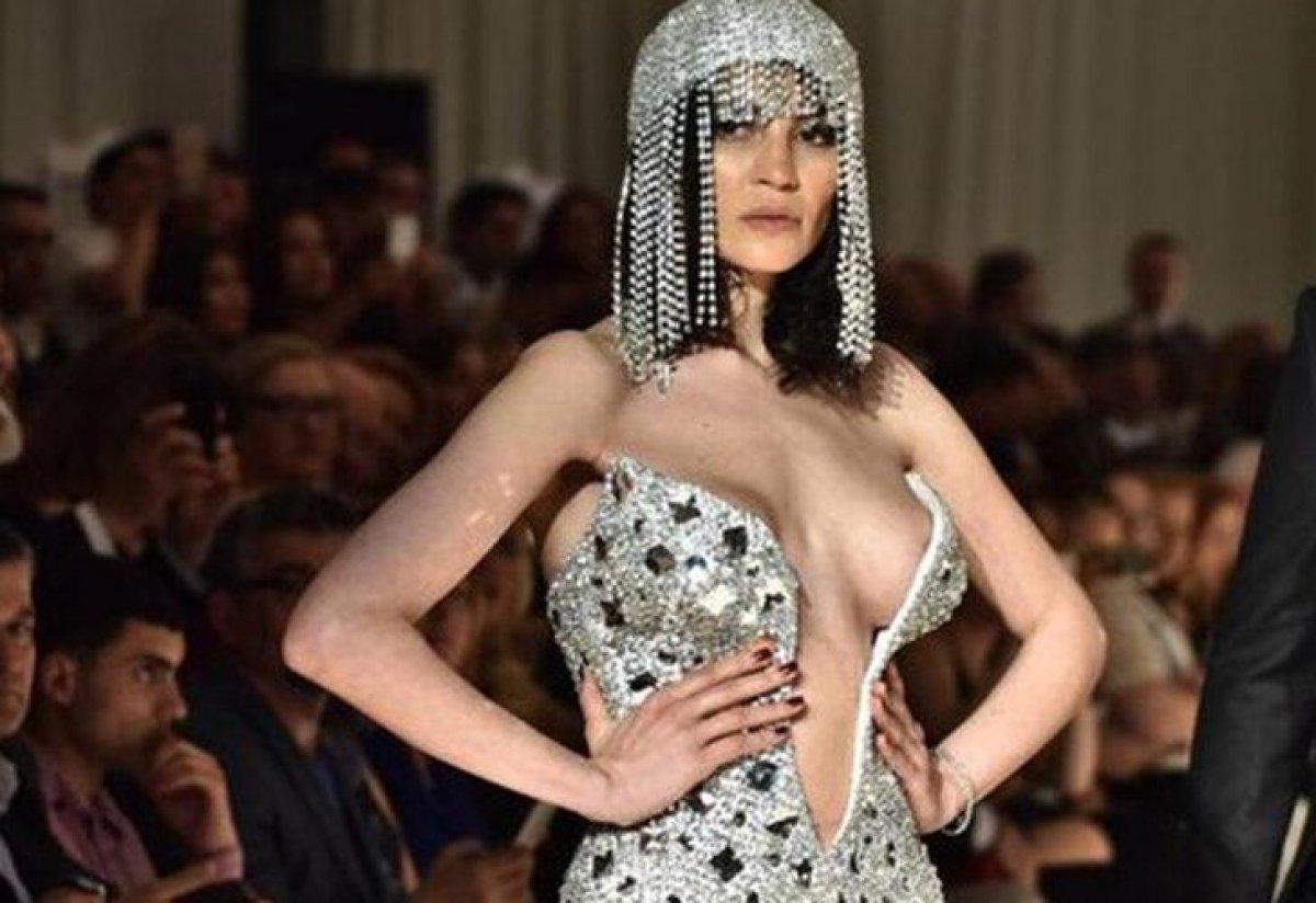 Günay Musayeva: Silikonlarımı çıkarttırdım