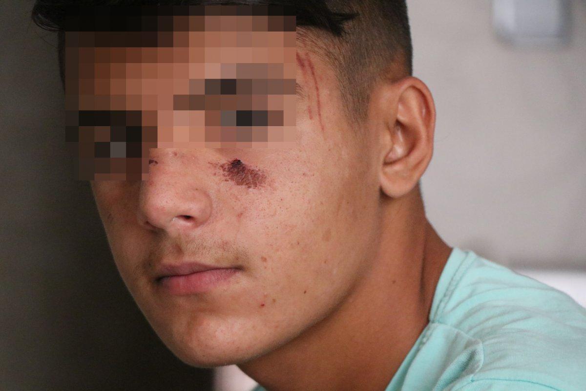 Aksaray’da, kız kardeşinin videosundaki 13 yaşındaki çocuğu öldüresiye dövdü