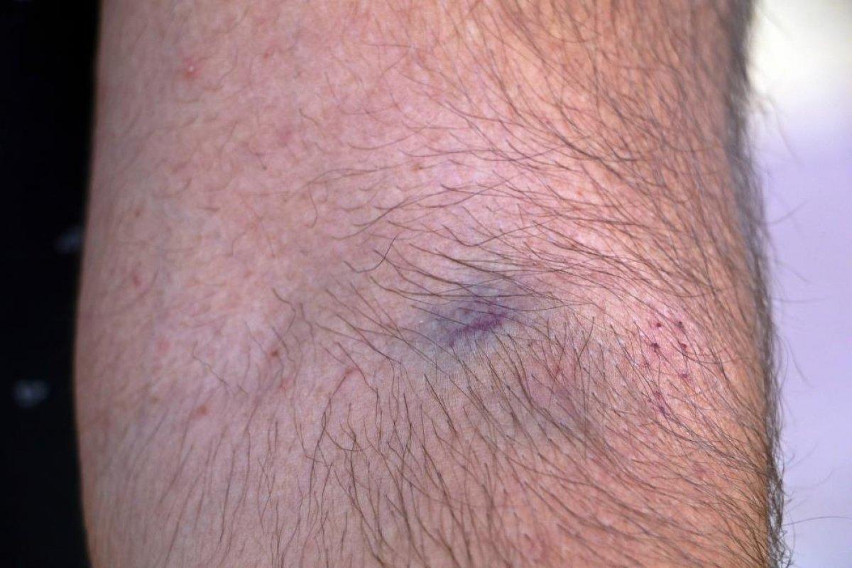 Antalya'da palalı saldırıya uğrayan aile konuştu