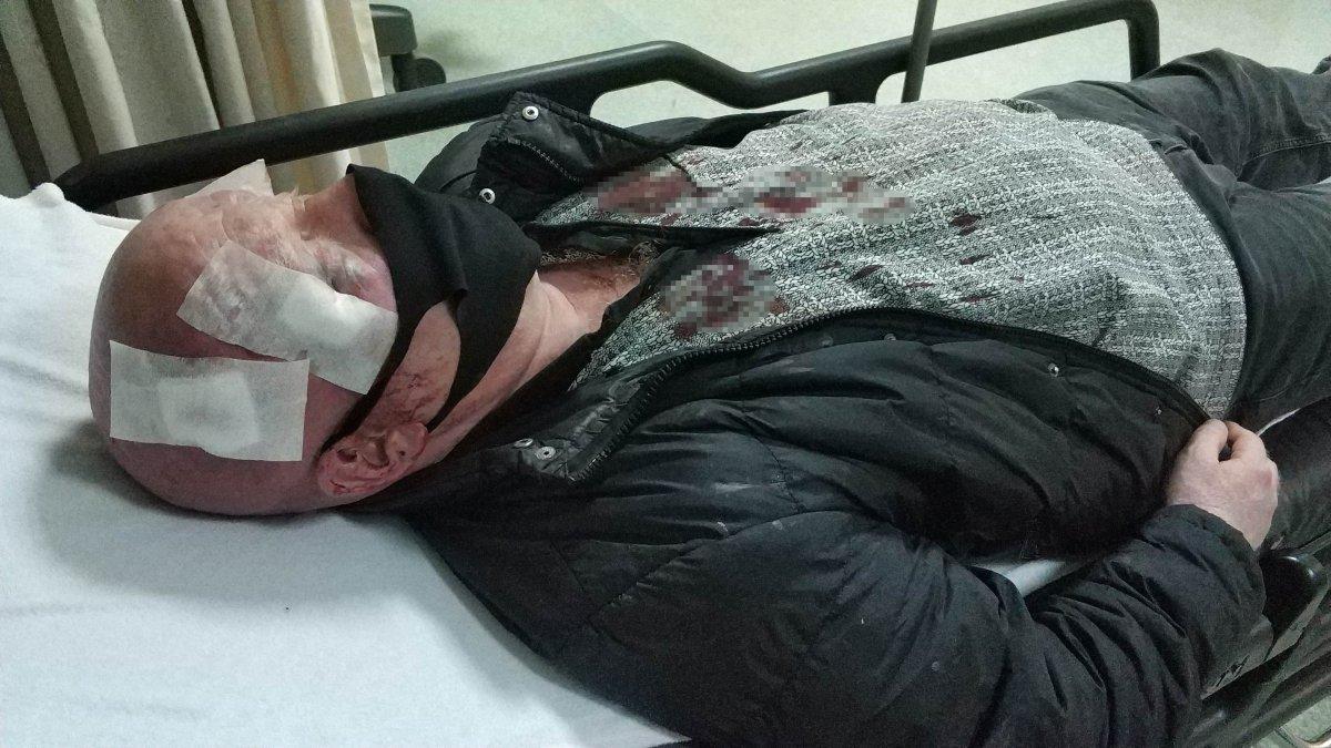 Samsun'da zurnacıyı hastanelik edip 10 bin lirasını gasbettiler