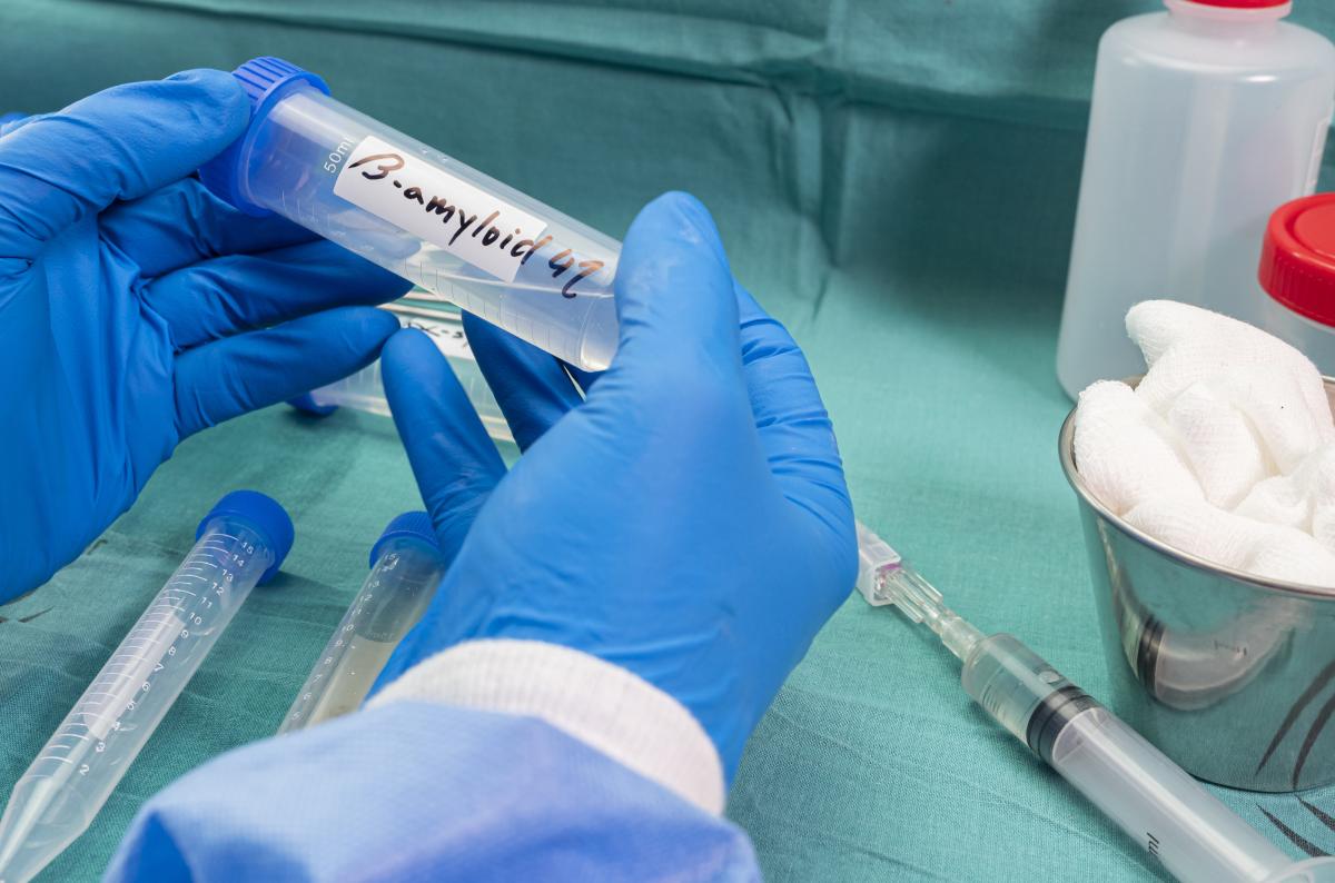 Alzheimer 2050’de dünya genelinde 3 katına çıkabilir