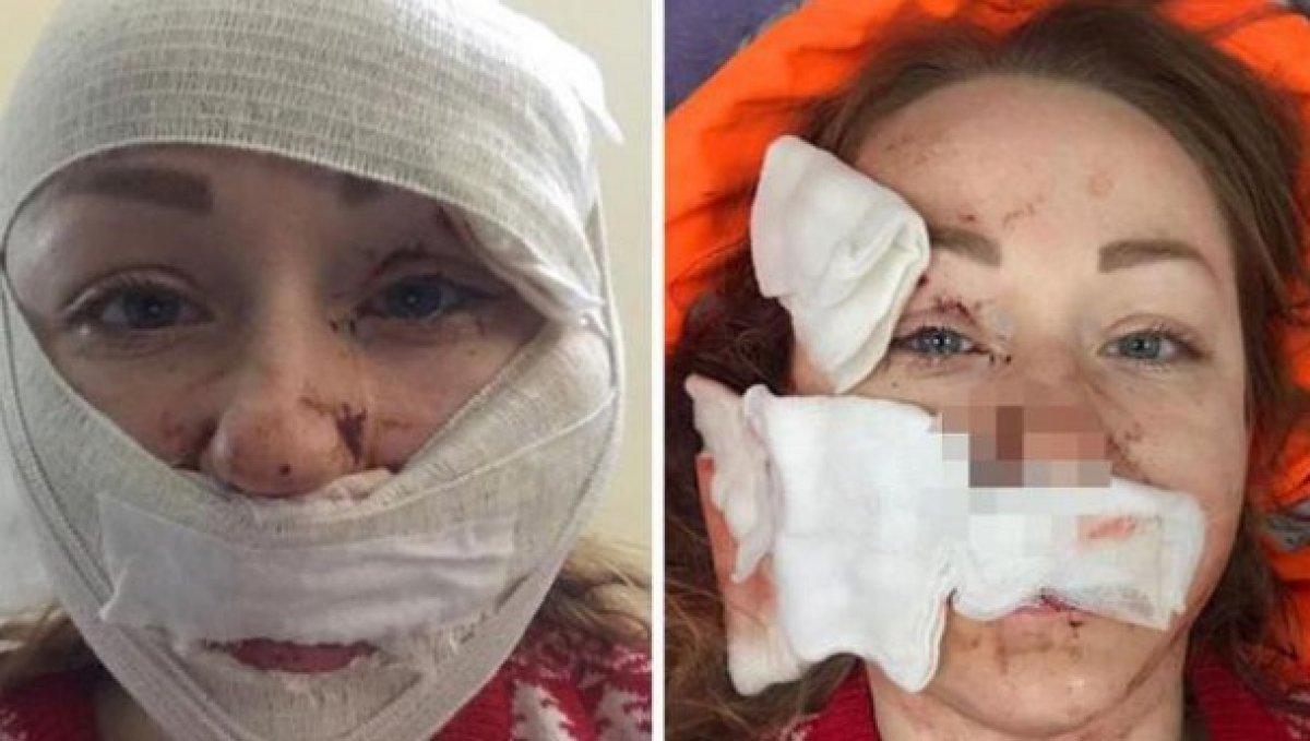 Bakırköy'de eşini falçata ile yaralayan sanığa 11 yıl 8 ay hapis cezası