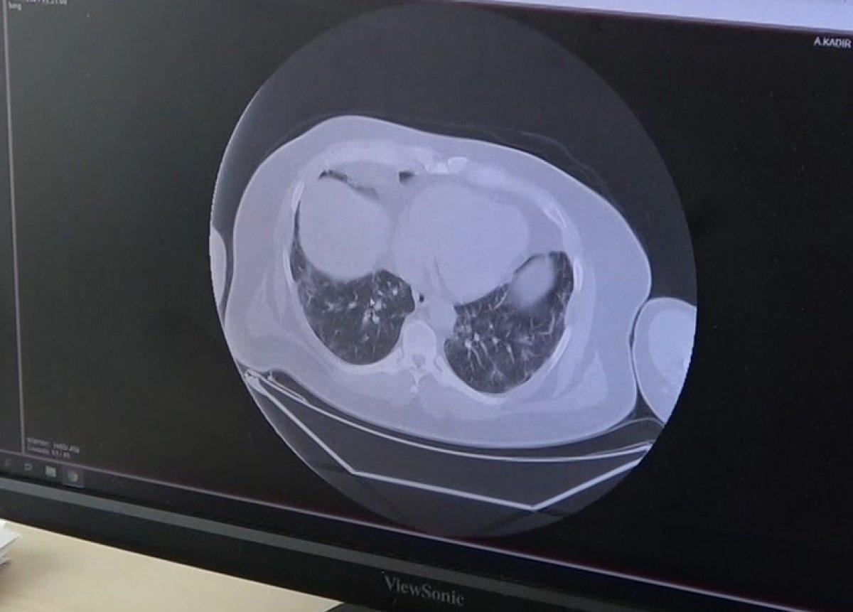 Gaziantep'te aşı randevusu yerine taziyeye gidince koronayı kaptı