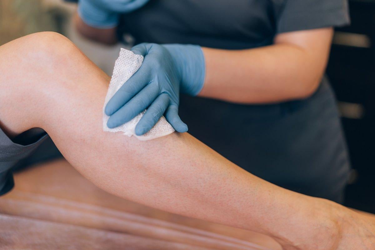 Kıl dönmesi nasıl olur, nasıl geçer?