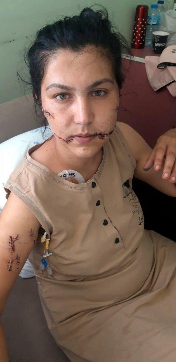 İzmir'de 104 yerinden bıçakladı, can çekişirken başında sigara içti