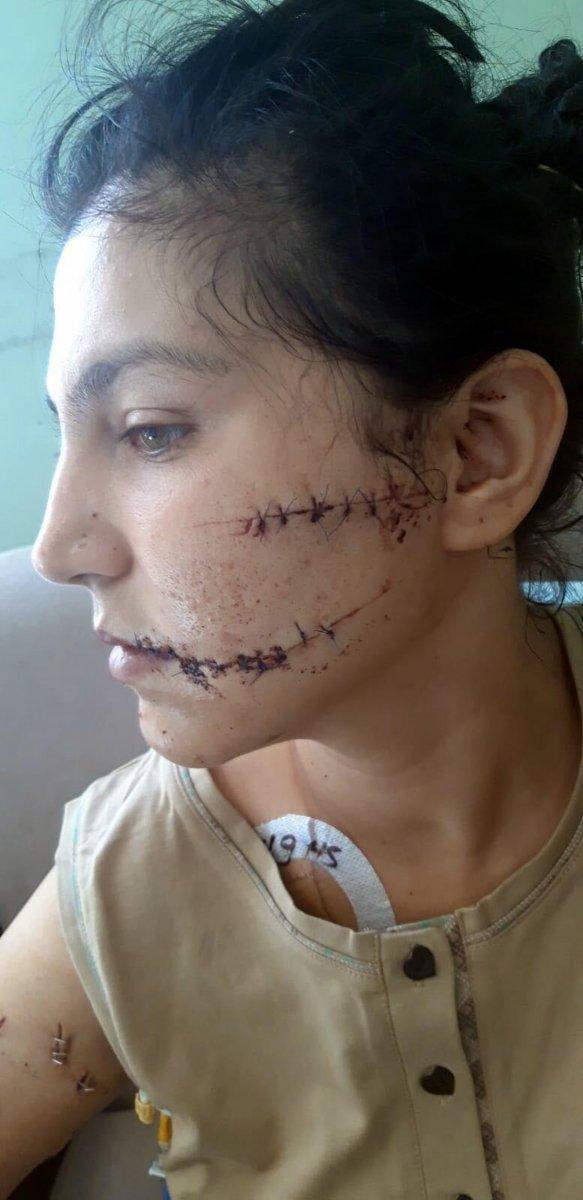 İzmir'de 104 yerinden bıçakladı, can çekişirken başında sigara içti