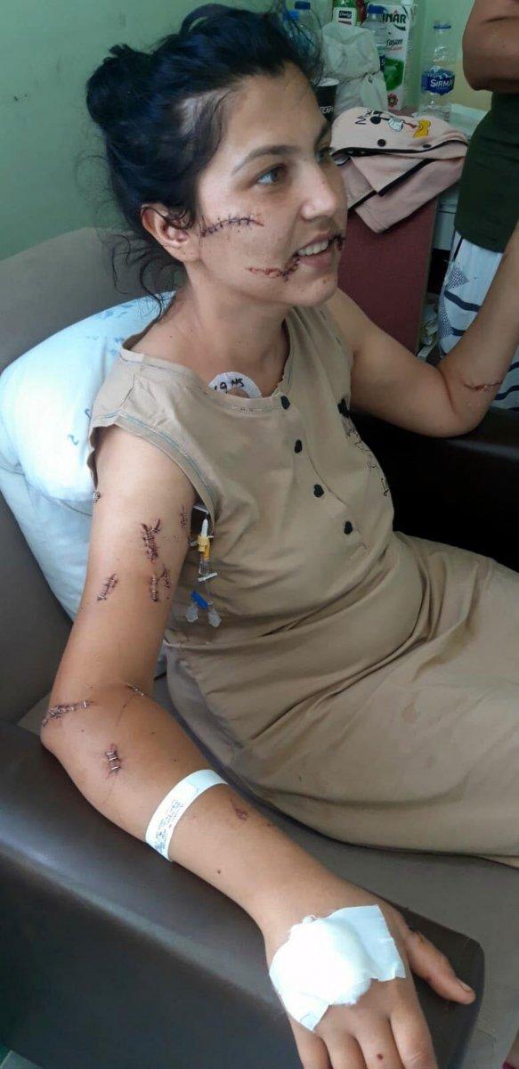 İzmir'de 104 yerinden bıçakladı, can çekişirken başında sigara içti