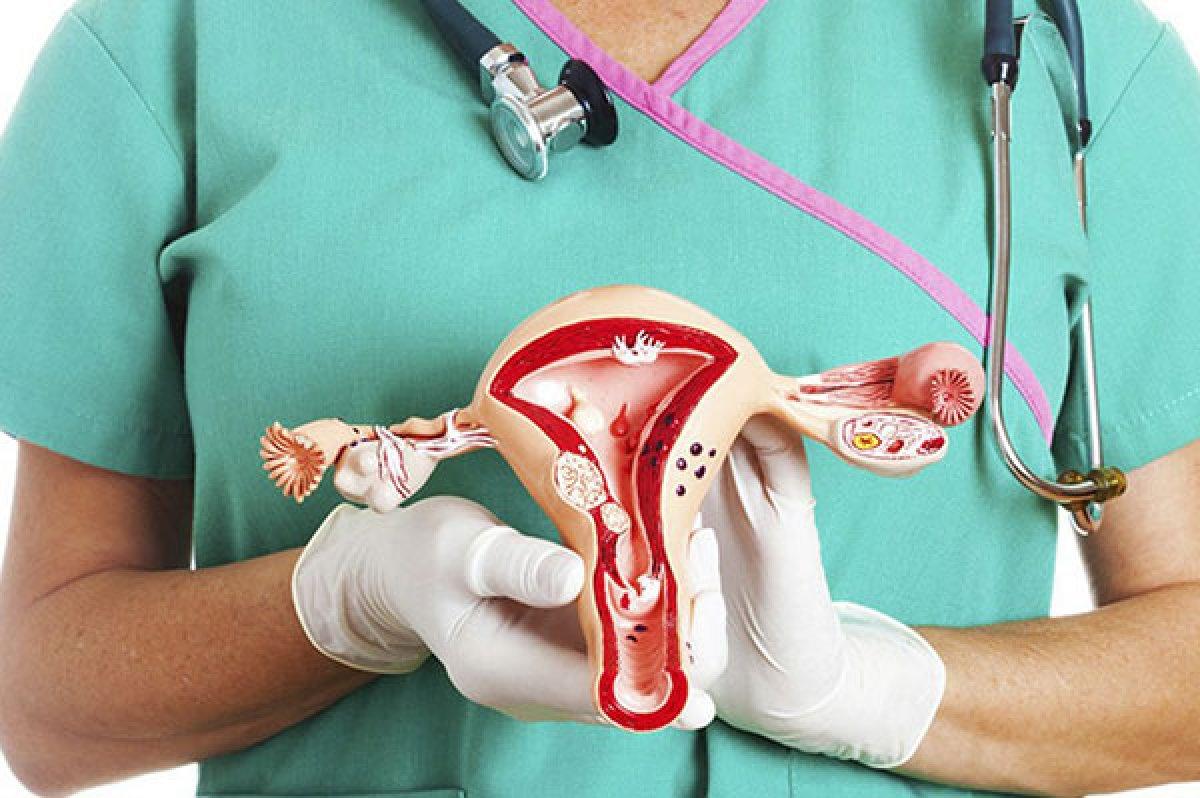 Kadınlarda Polikistik Over Sendromu ve tedavisi