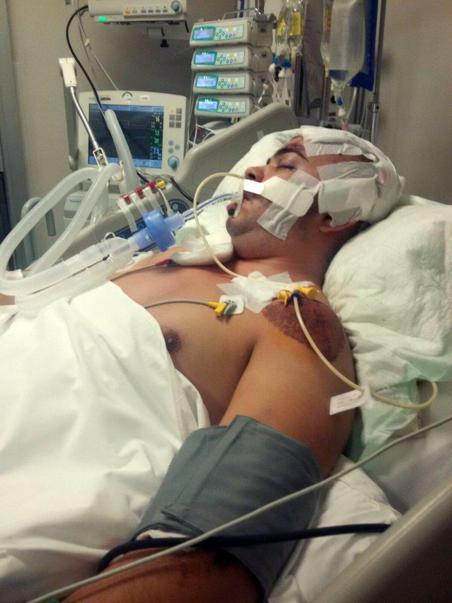 Antalya'da 752 gün komada kalan Semih, hayata tutundu