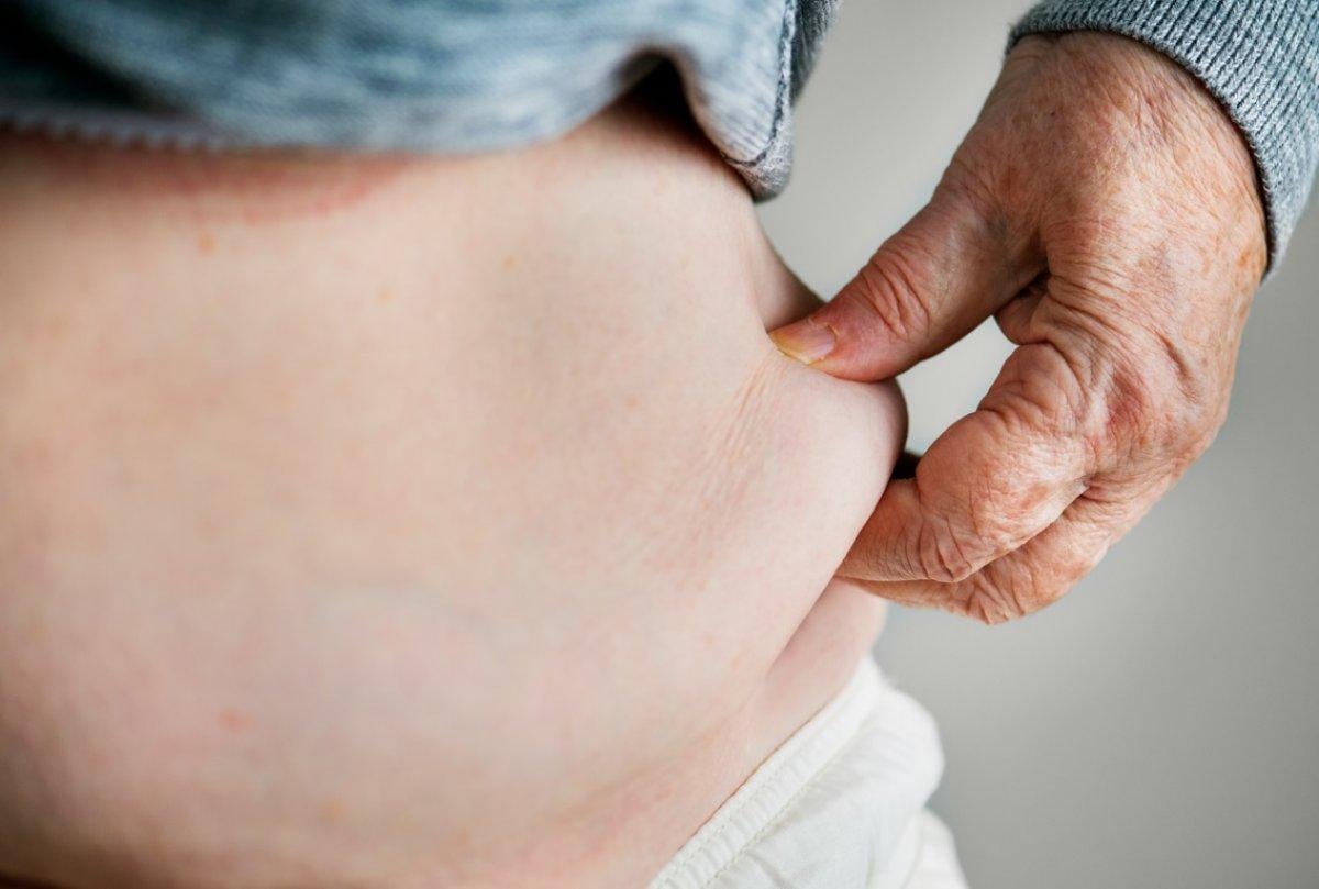 Beyin kanaması belirtileri ve önlemek için ipuçları