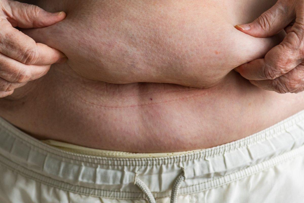 Vücutta stresten etkilenen 10 bölge