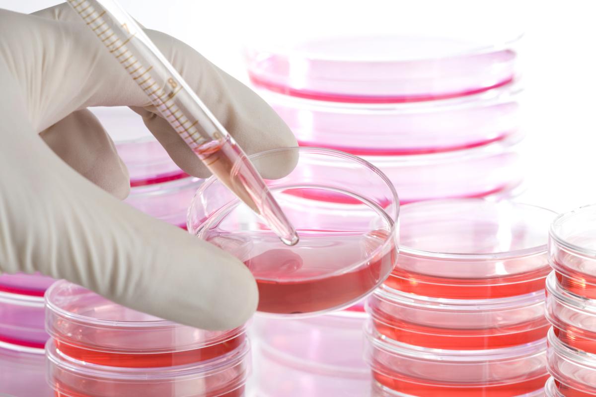 Kök hücre ile menisküs kireçlenmesi tedavi edilebiliyor