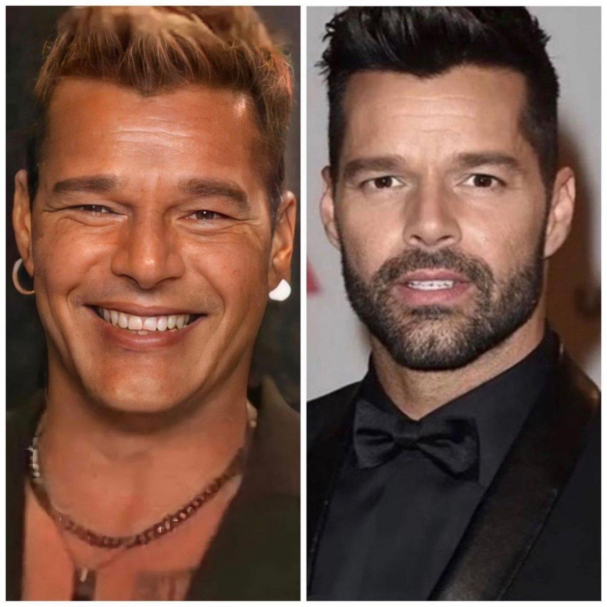 Ricky Martin'in son hali