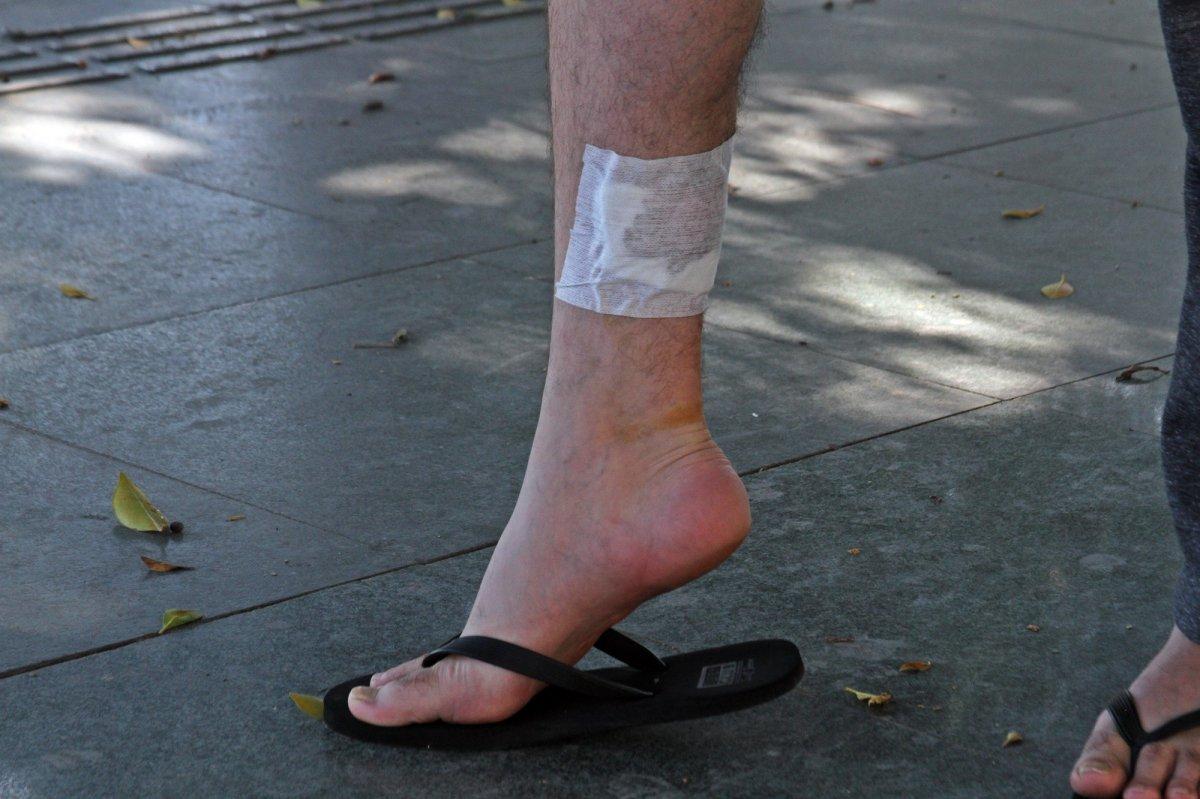 Antalya’da kızına balon almak için yürürken köpek saldırdı