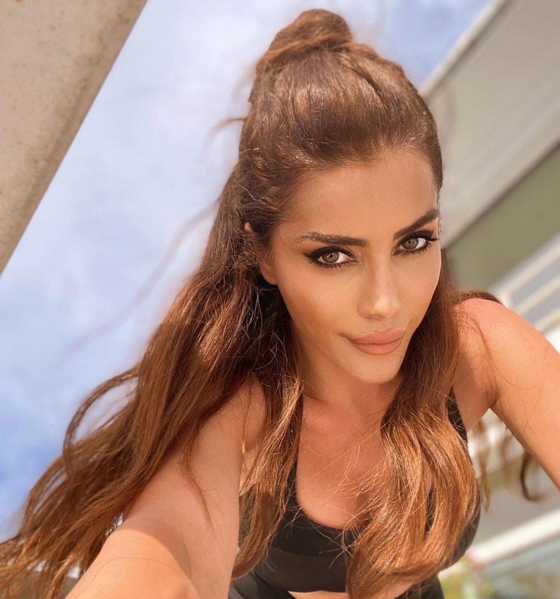 Spiker Ela Rumeysa Cebeci, sokak köpeğinin saldırısına uğradı