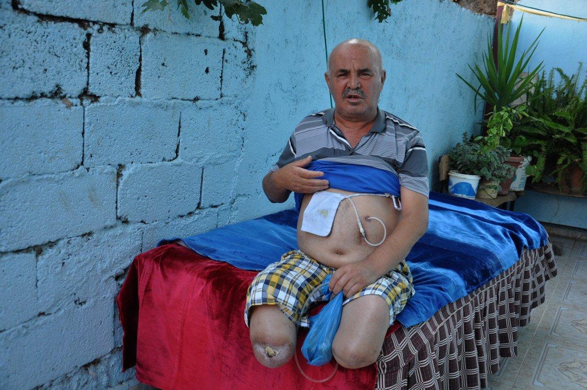 Gaziantep’te, ayakları kesilen adamın akülü sandalye çağrısı