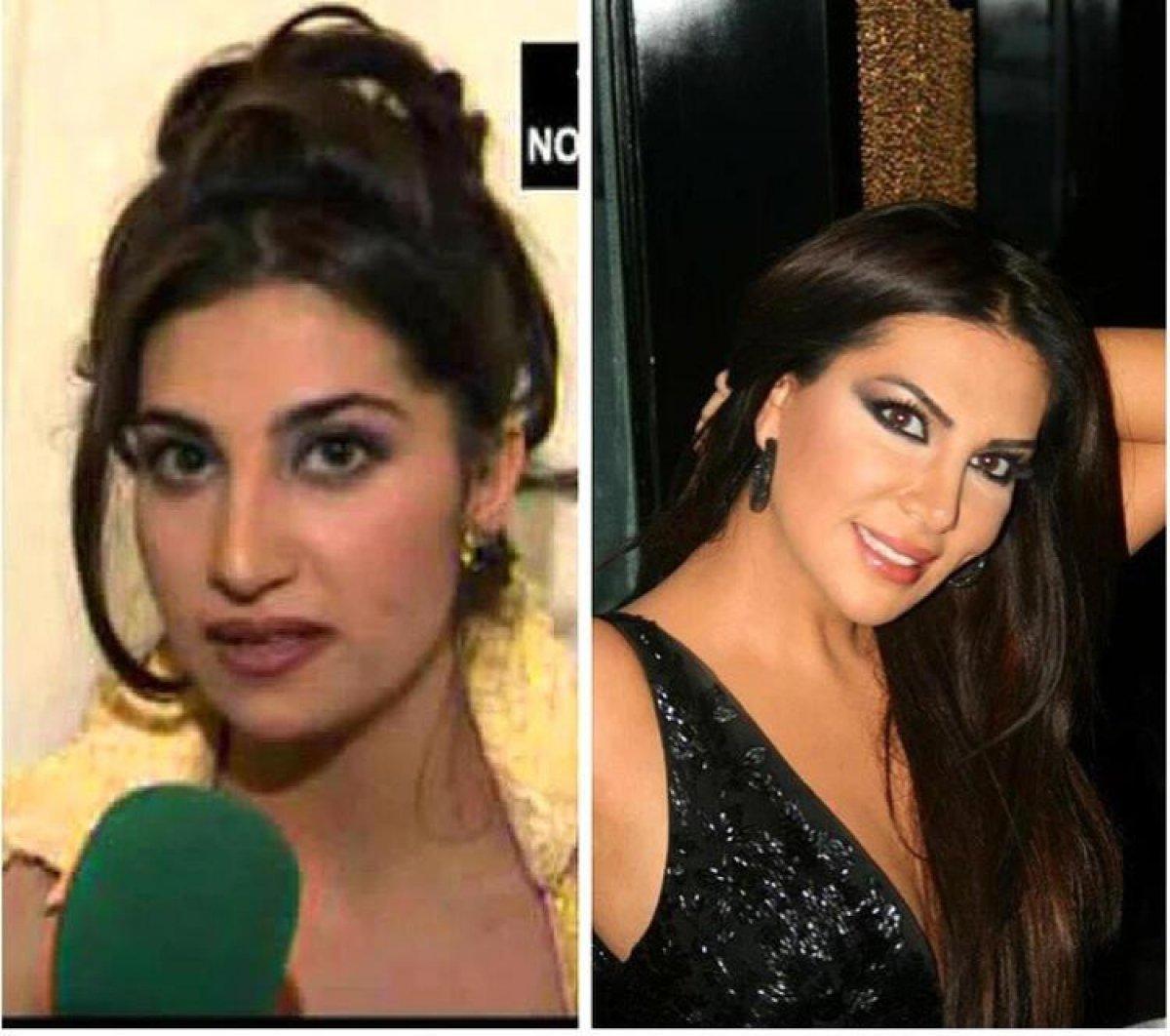 Ebru Yaşar: Estetiğe karşı değilim