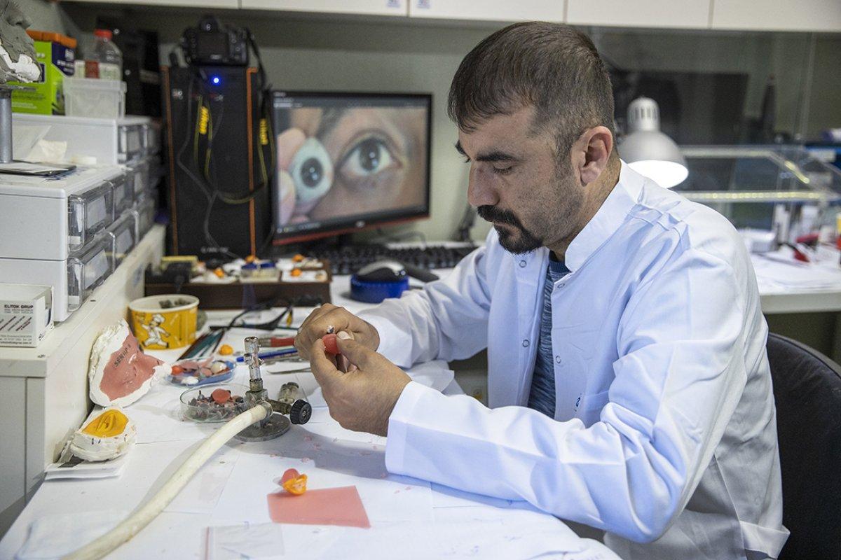 Göz protezcisi Adem Uçar, gerçeğinden ayırt edilemeyecek protez gözler hazırlıyor