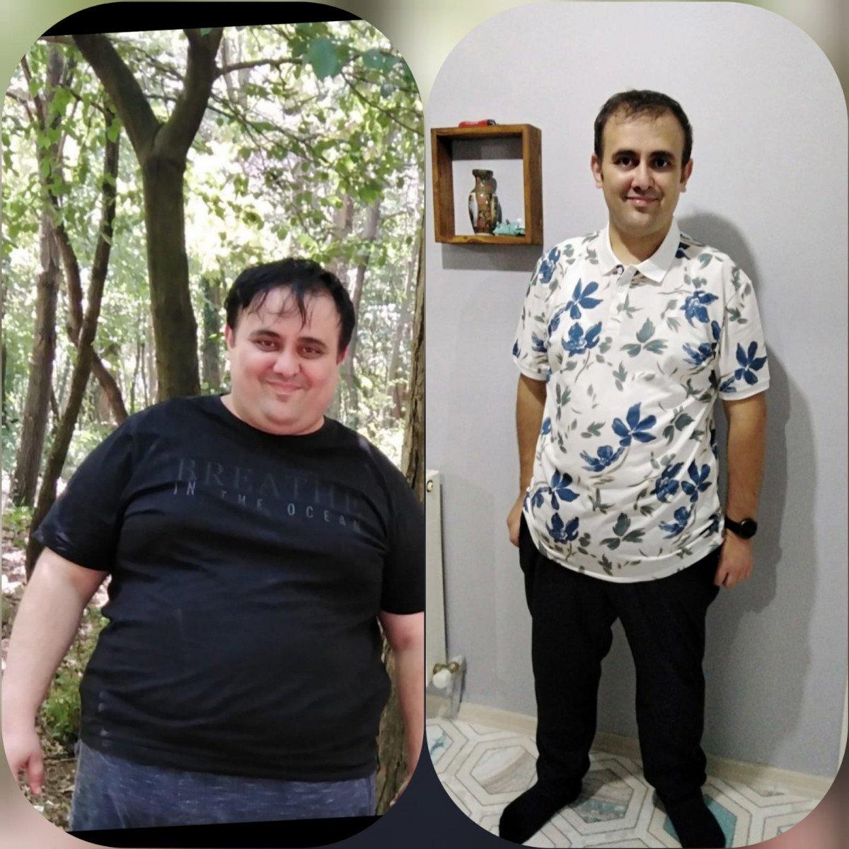 İstanbul’da ameliyat sonrası 57 kilo verdi, 10 yaş birden gençleşti