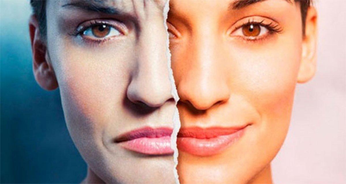 Bipolar bozukluk nedir