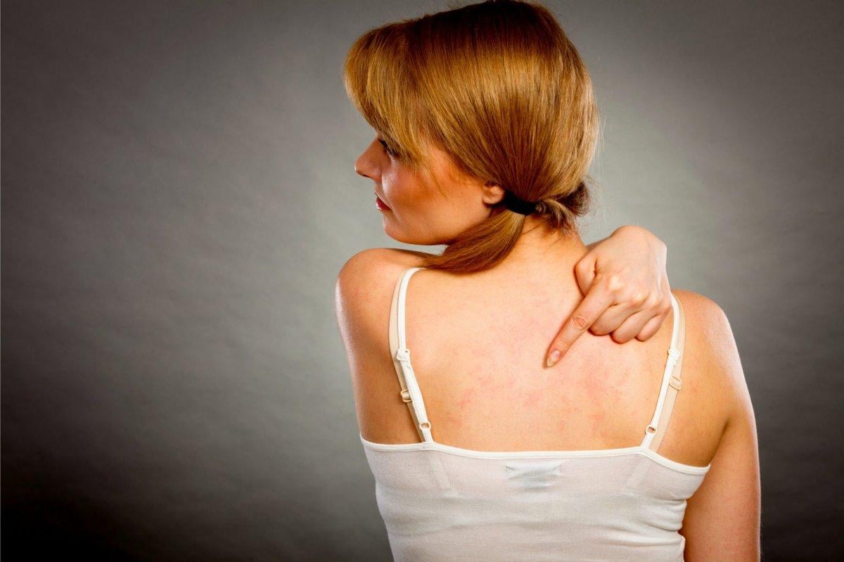 Diyabetin varlığını işaret eden 4 cilt problemi