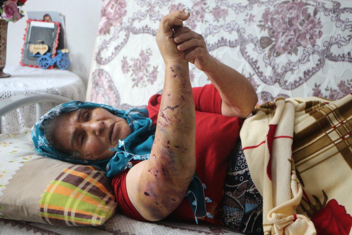 Tokat'ta komşusundan dönen kadına köpek saldırdı