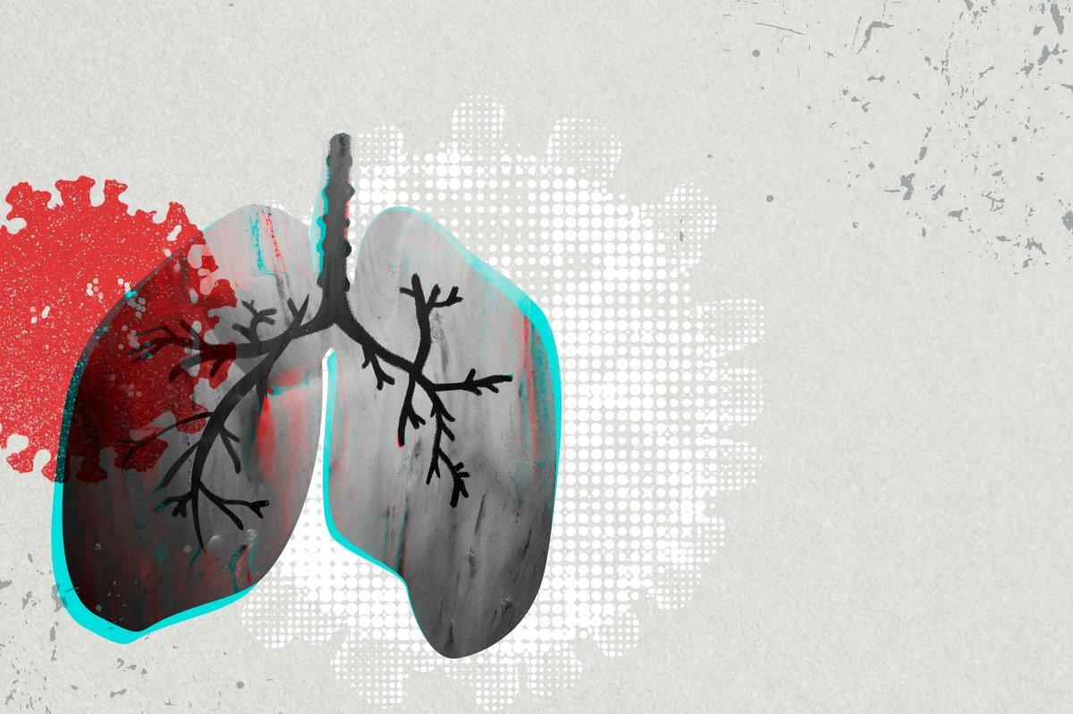 Koronavirüs sonrası en sık görülen 10 sağlık sorunu