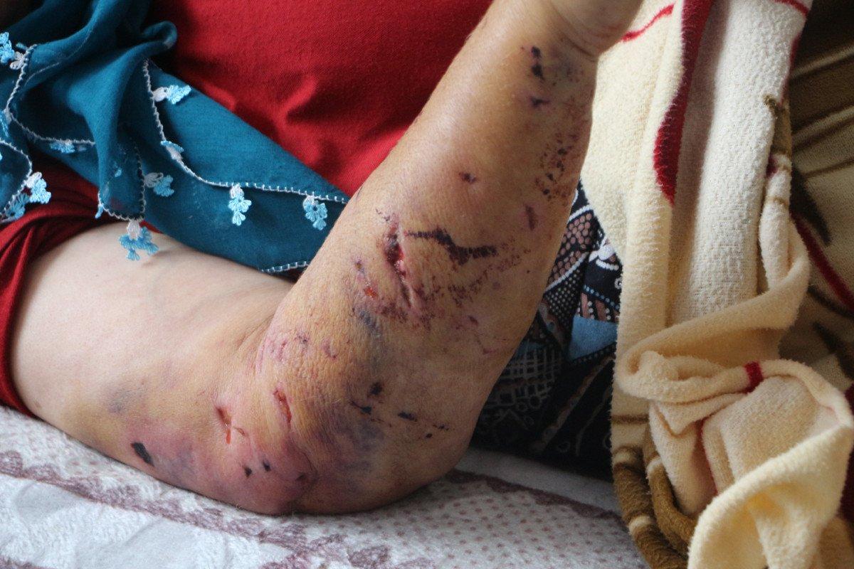 Tokat'ta komşusundan dönen kadına köpek saldırdı