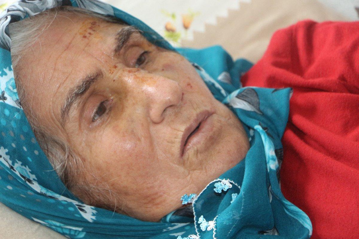 Tokat'ta komşusundan dönen kadına köpek saldırdı