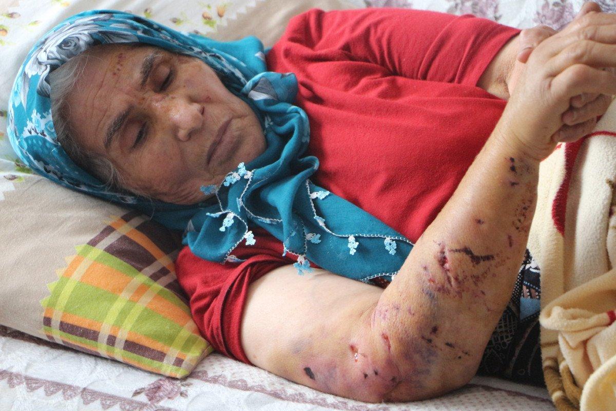 Tokat'ta komşusundan dönen kadına köpek saldırdı