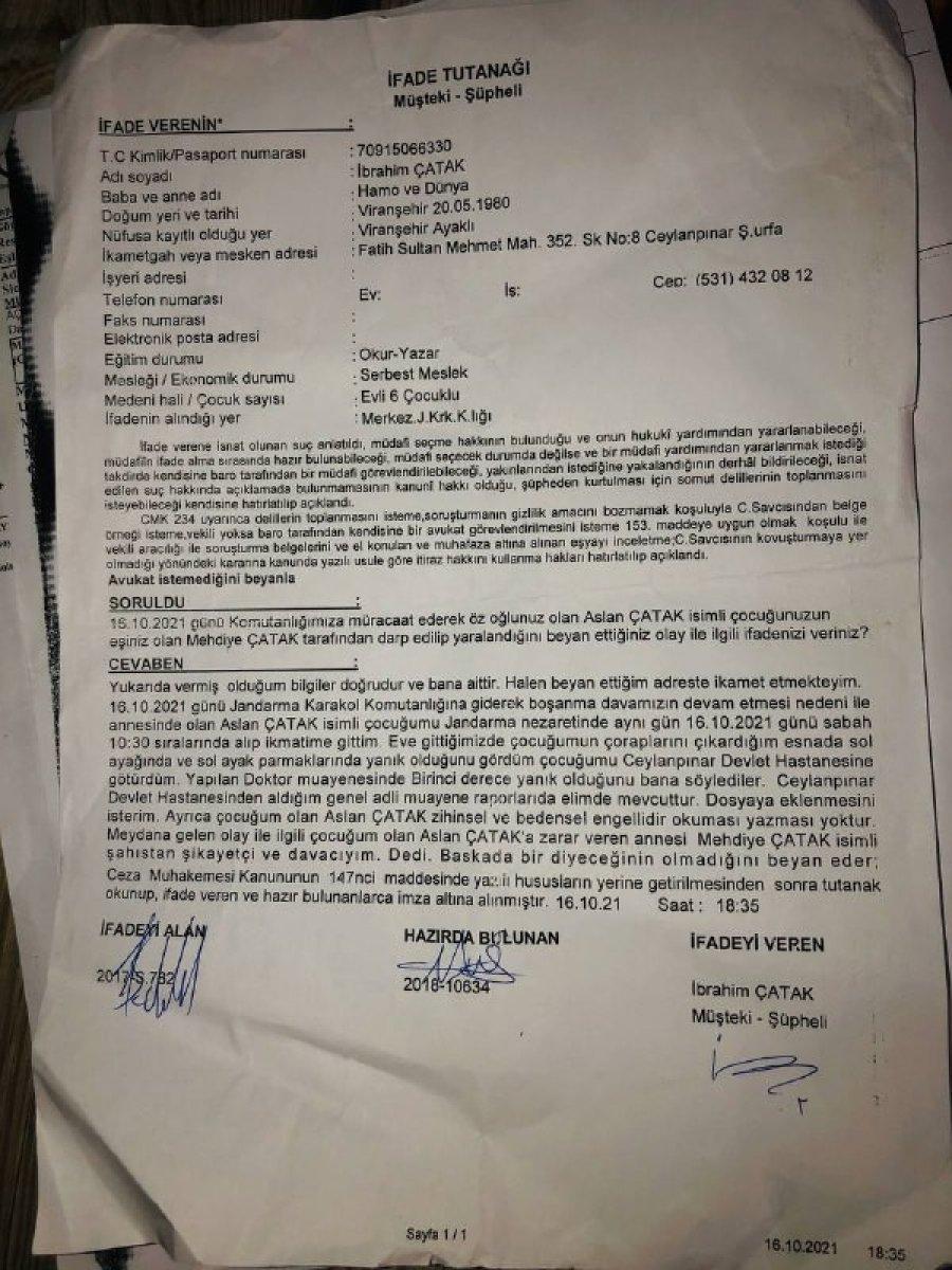 Şanlıurfa'daki adam engelli oğluna işkence eden eşinden şikayetçi