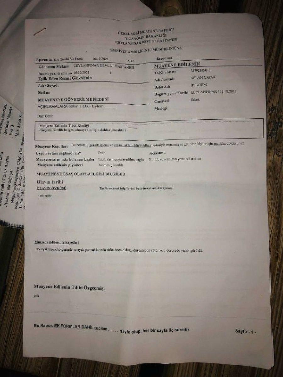 Şanlıurfa'daki adam engelli oğluna işkence eden eşinden şikayetçi