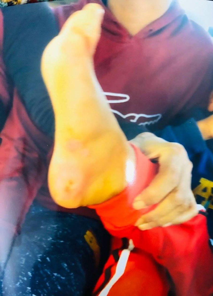 Şanlıurfa'daki adam engelli oğluna işkence eden eşinden şikayetçi