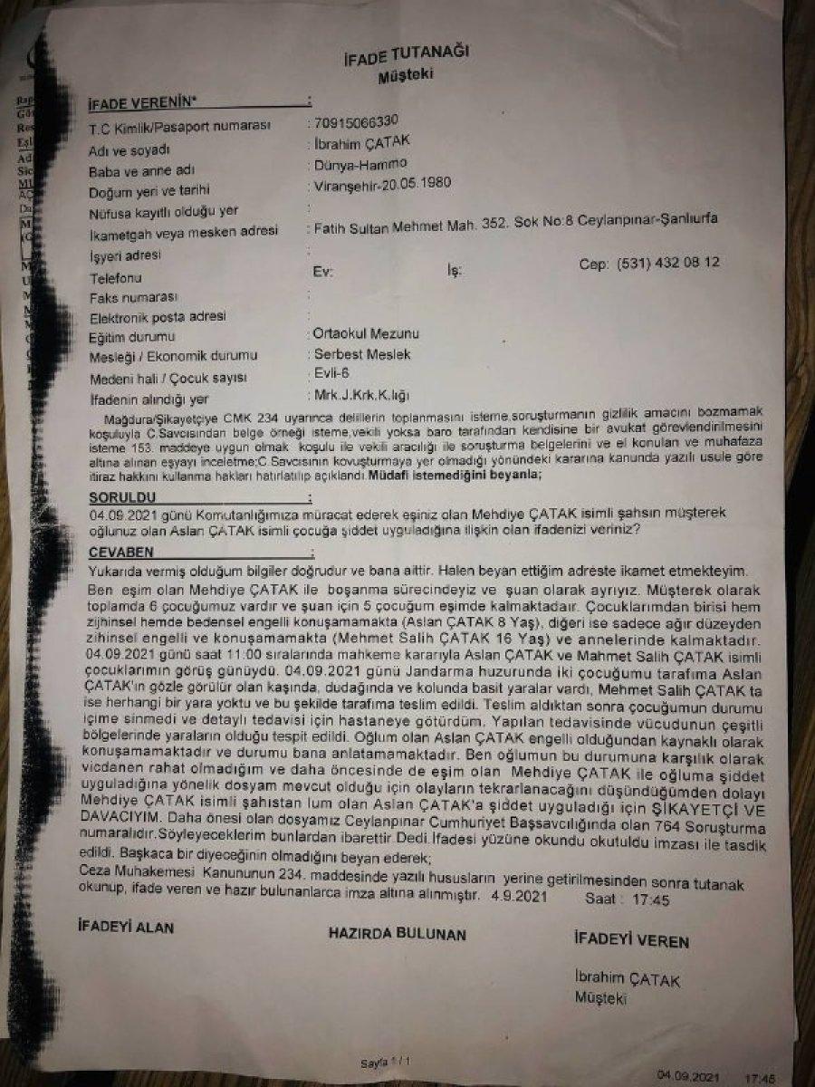 Şanlıurfa'daki adam engelli oğluna işkence eden eşinden şikayetçi