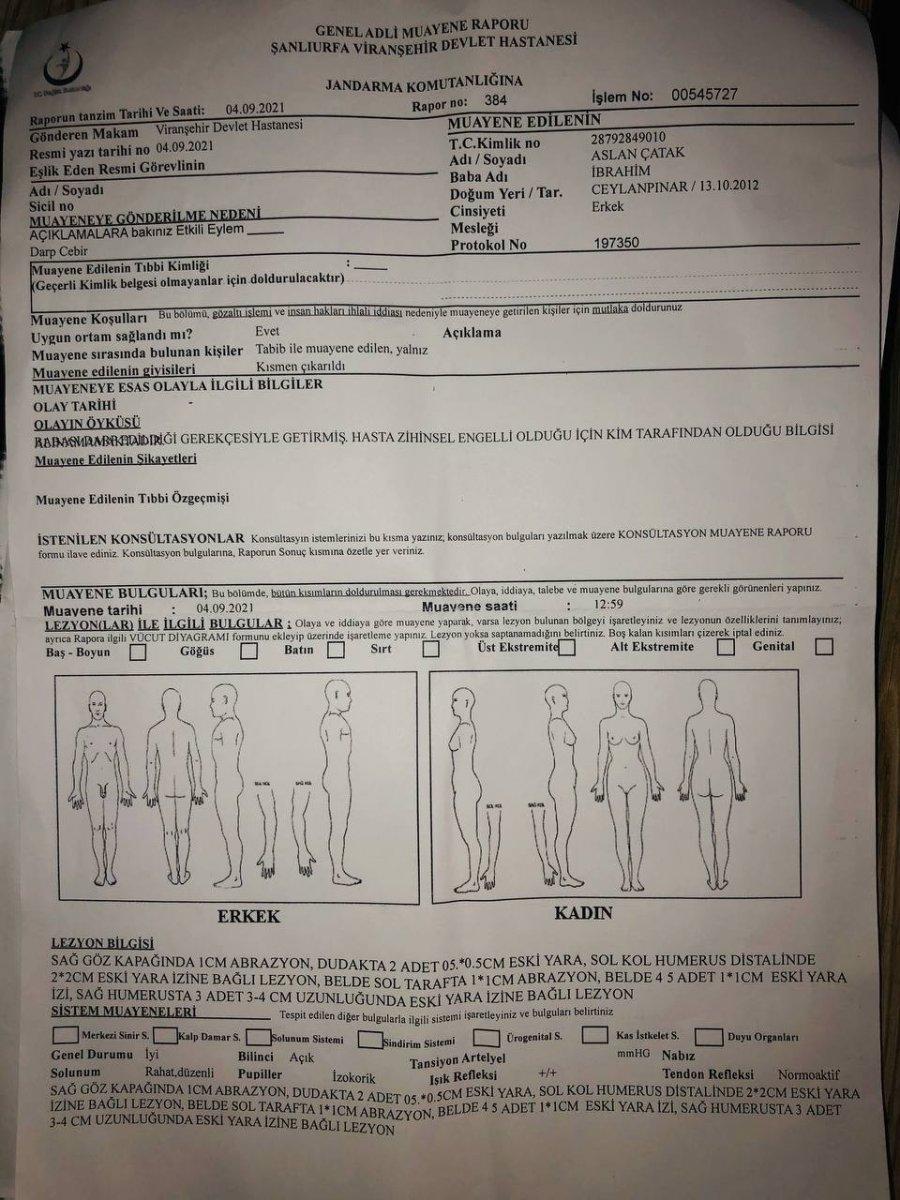 Şanlıurfa'daki adam engelli oğluna işkence eden eşinden şikayetçi