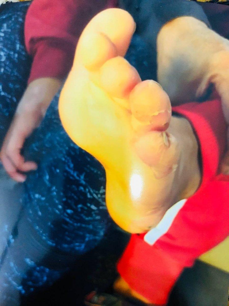 Şanlıurfa'daki adam engelli oğluna işkence eden eşinden şikayetçi