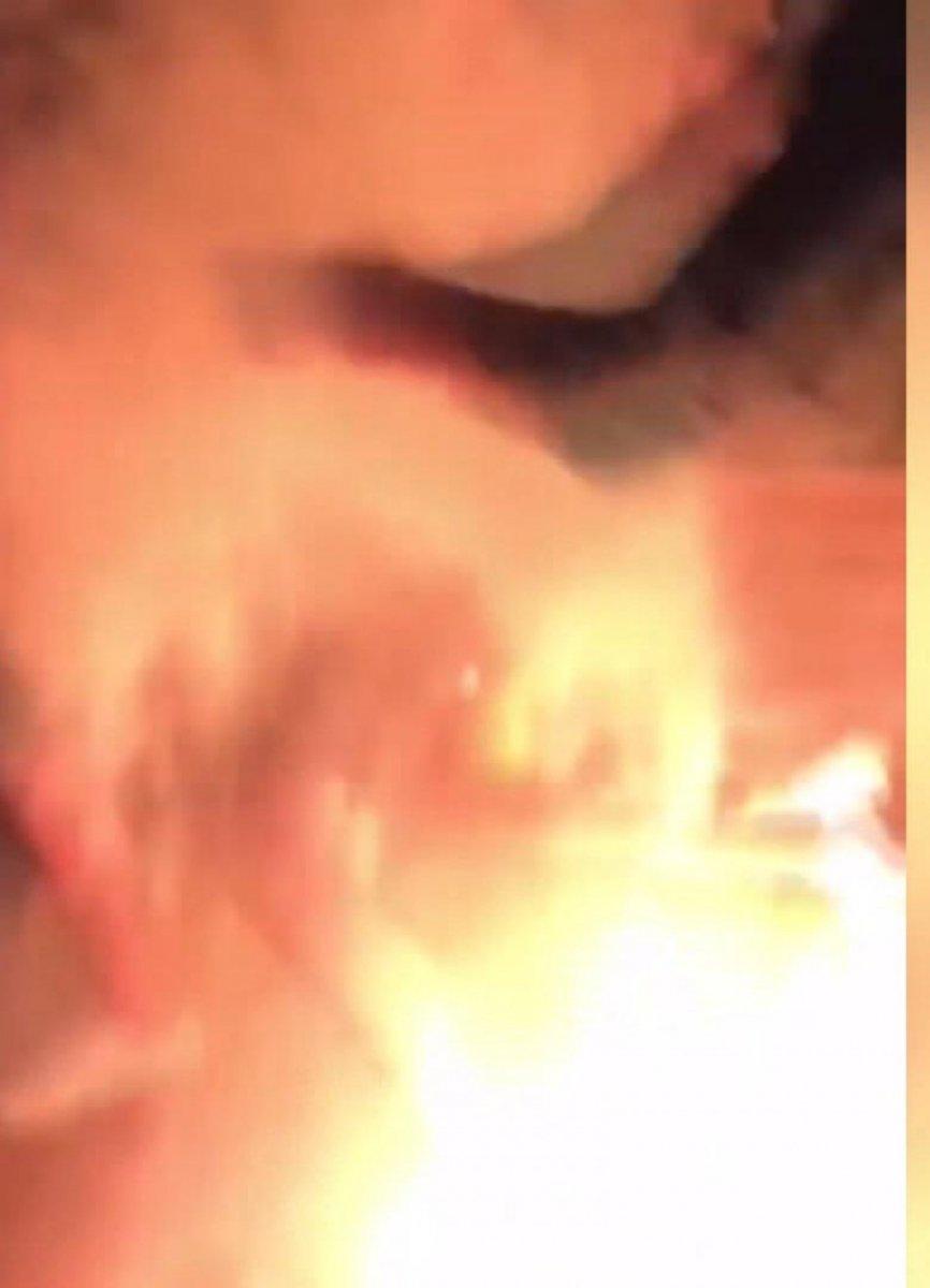 Kadıköy’de, doğum gününde yapılan unlu şaka yüzünden vücudu yandı